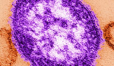 Measles cases top 900 in PA