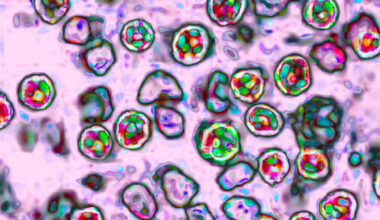 Pennsylvania teen dies from measles complications, the state’s fourth death
