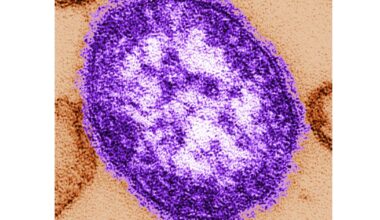 Pennsylvania officials report state's 3rd death involving measles