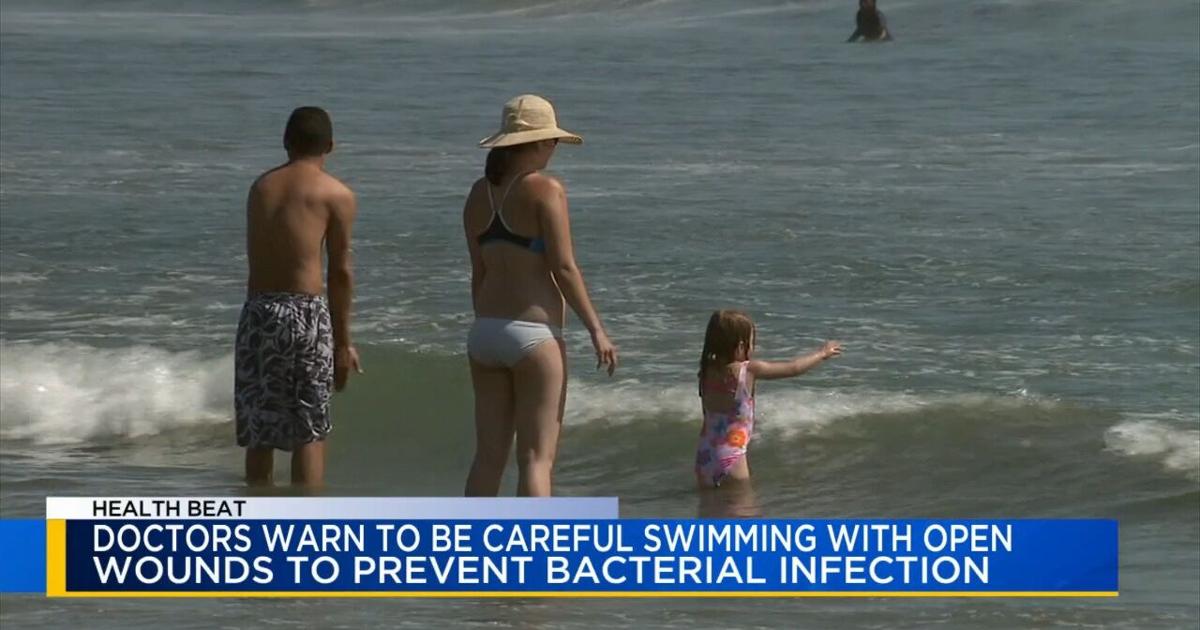 Health Beat: Doctors warn about the dangers of swimming with an open wound | Health Beat