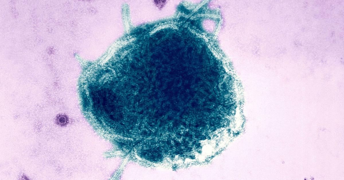 Pennsylvania reports fourth measles-related death, the most in US in decades | Health