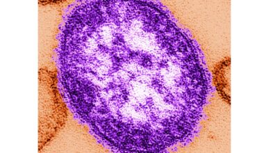Pennsylvania officials report state's 3rd death involving measles :: WRAL.com