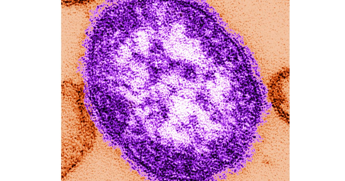 Pennsylvania officials report state's 3rd death involving measles :: WRAL.com