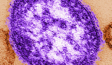 Coroner shares details of infant deaths amid Pennsylvania measles outbreak