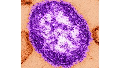 Coroner releases details of infants who died amid growing Pennsylvania measles outbreak