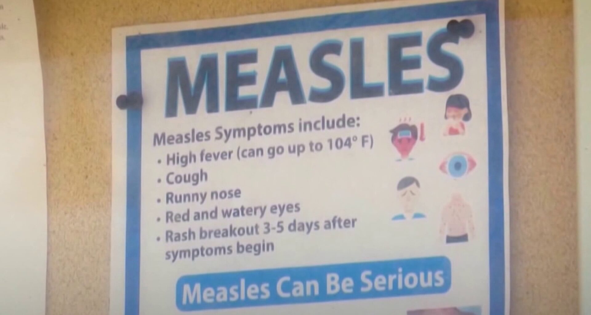 Measles outbreak in PA nears 800 cases as Department of health urges vaccination