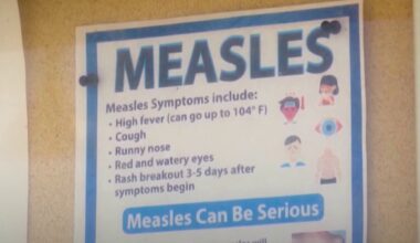 Measles outbreak in PA nears 800 cases as Department of health urges vaccination