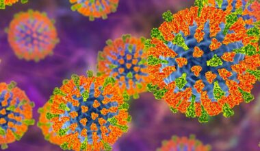 Possible measles exposure reported at Pennsylvania Turnpike service plaza