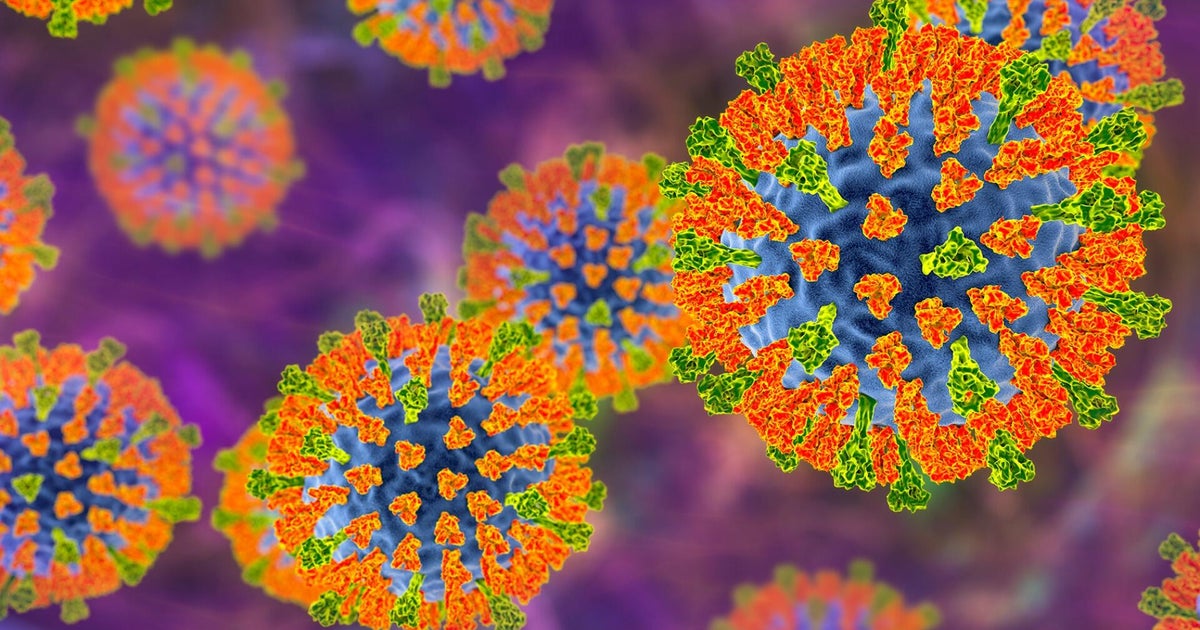 Possible measles exposure reported at Pennsylvania Turnpike service plaza