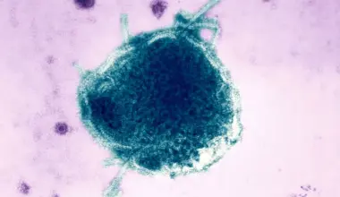 Pennsylvania reports fourth measles-related death, the most in US in decades