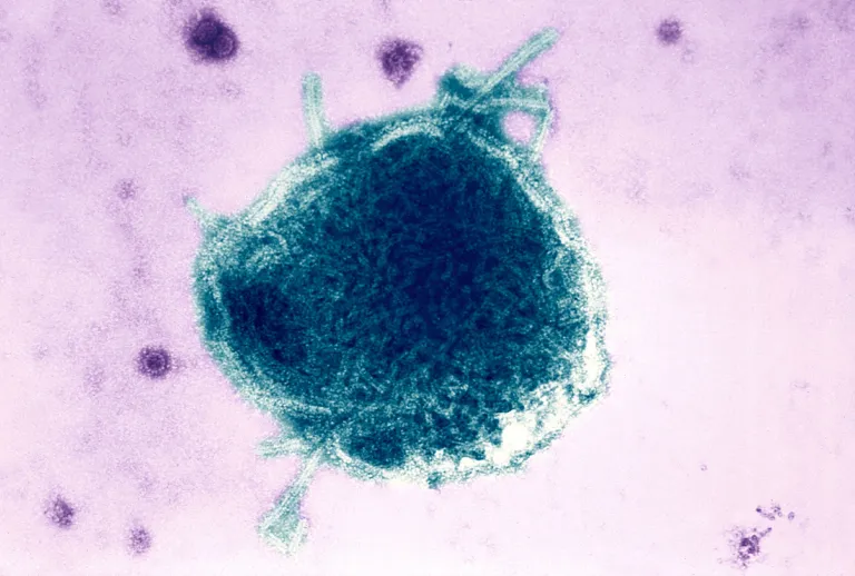 Pennsylvania reports fourth measles-related death, the most in US in decades