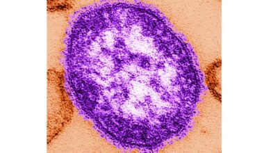 Pennsylvania reports third measles-related death amid growing outbreak