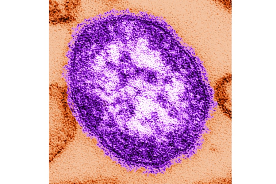Pennsylvania reports third measles-related death amid growing outbreak