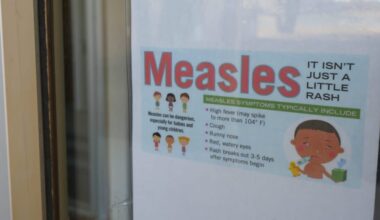 Pennsylvania woman dies from measles complications