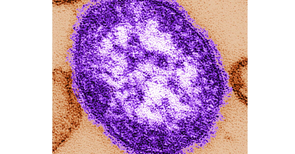 Pennsylvania officials report state's 3rd death involving measles