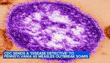 CDC to send 'disease detective' to Pennsylvania as measles outbreak soars