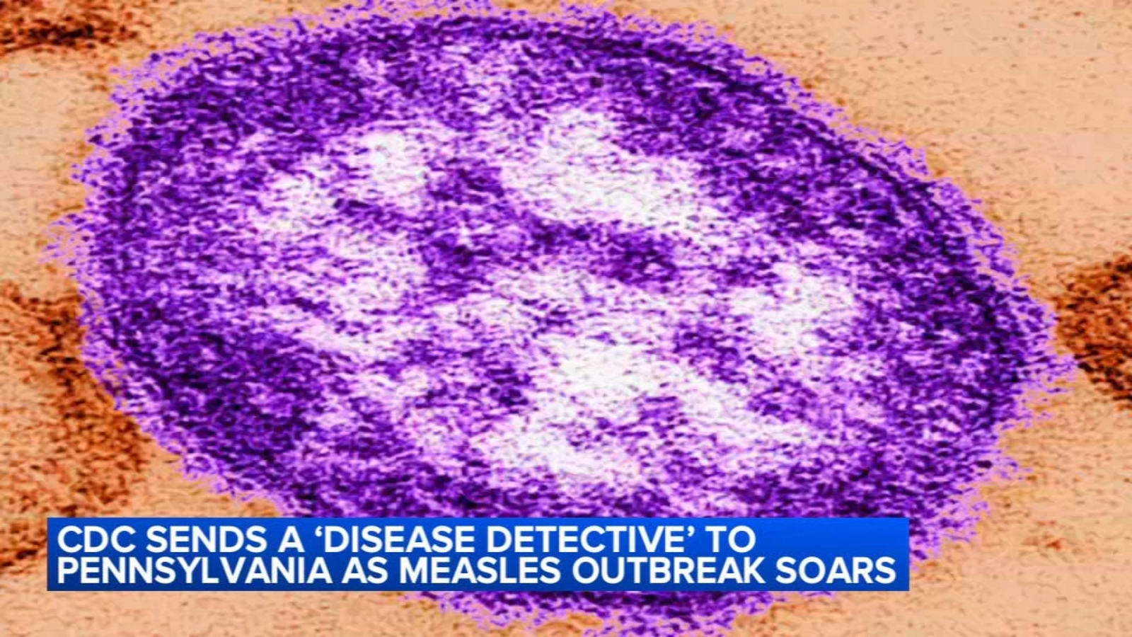 CDC to send 'disease detective' to Pennsylvania as measles outbreak soars