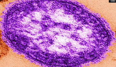 Measles Outbreak in Pennsylvania Highlights Vaccine Skepticism and Public Health Trust | Washington D.C.