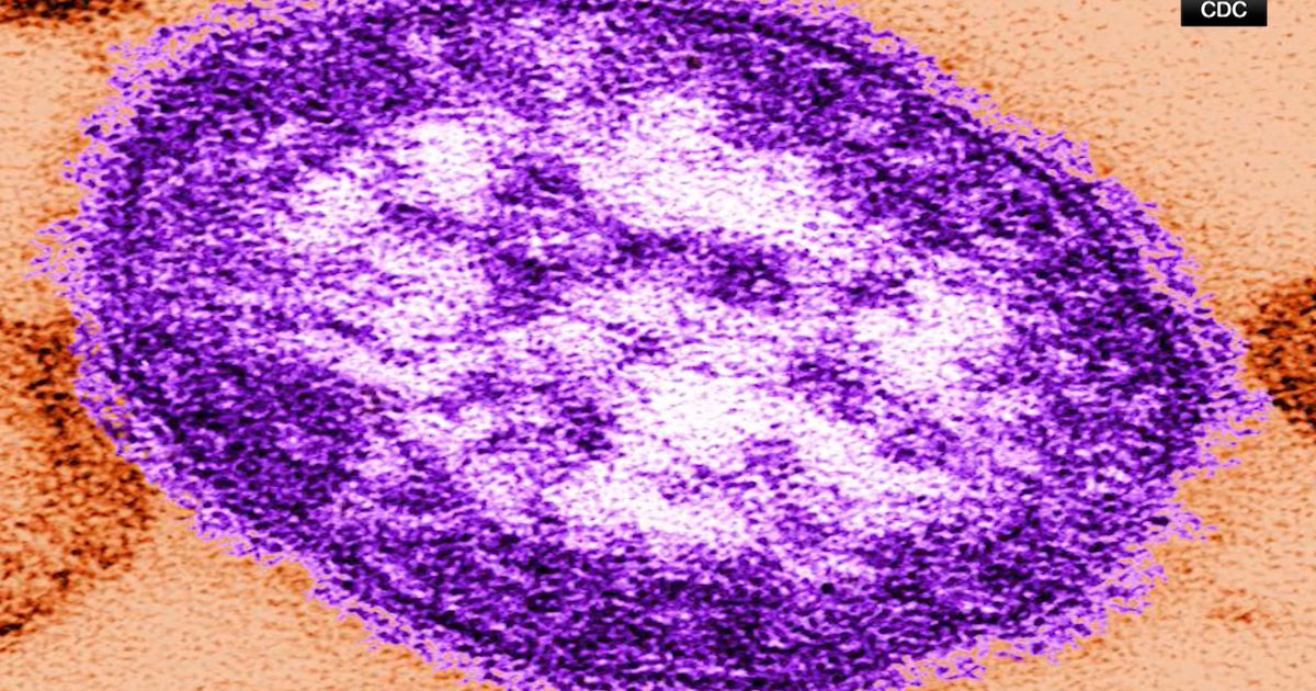 Measles Outbreak in Pennsylvania Highlights Vaccine Skepticism and Public Health Trust | Washington D.C.
