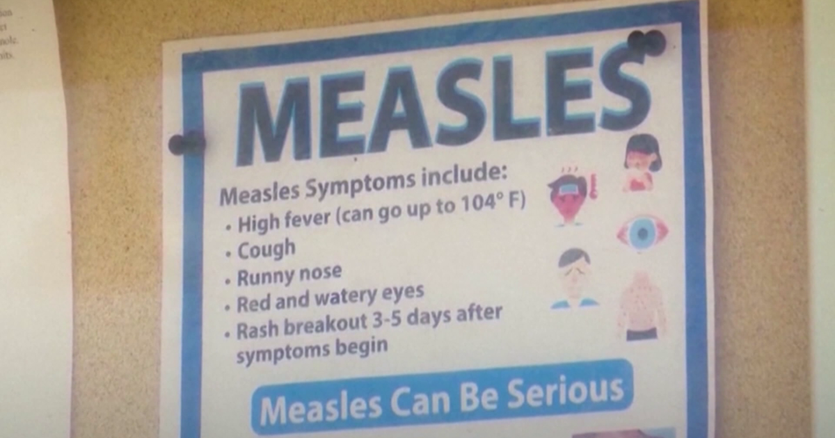 PA Tops 1,000 Measles Cases as New York Declares Emergency | News