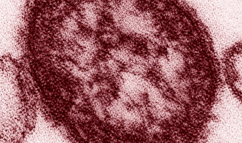 Measles milestones: US closes in on 4,000 cases as Pennsylvania nears 1,000