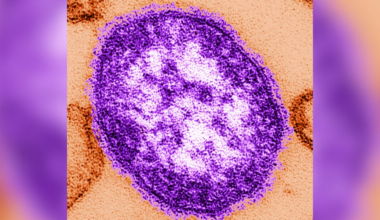 Pennsylvania records 5th measles death amid worst US year since 1991