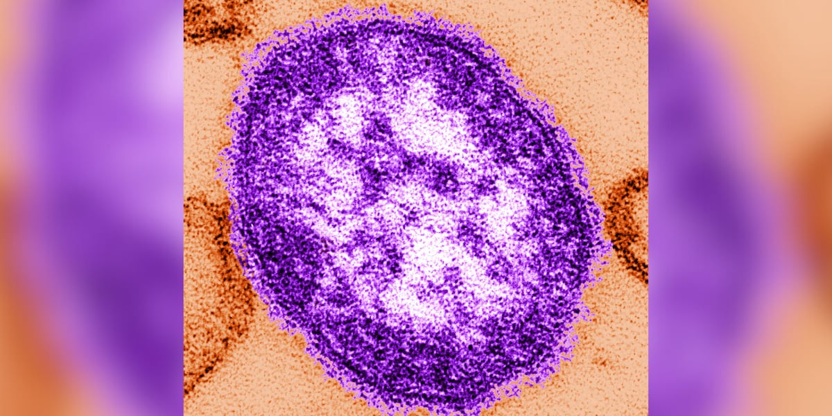 Pennsylvania records 5th measles death amid worst US year since 1991