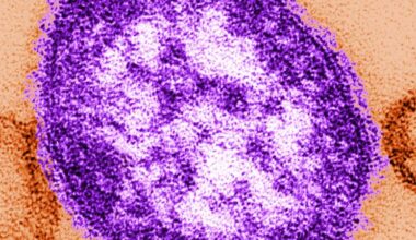 Pennsylvania tallies a fifth death related to measles as outbreak approaches a thousand cases