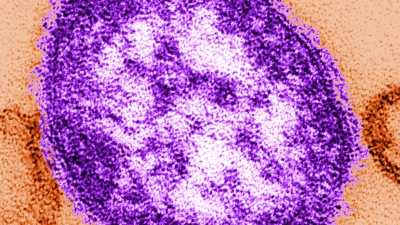 Pennsylvania tallies a fifth death related to measles as outbreak approaches a thousand cases