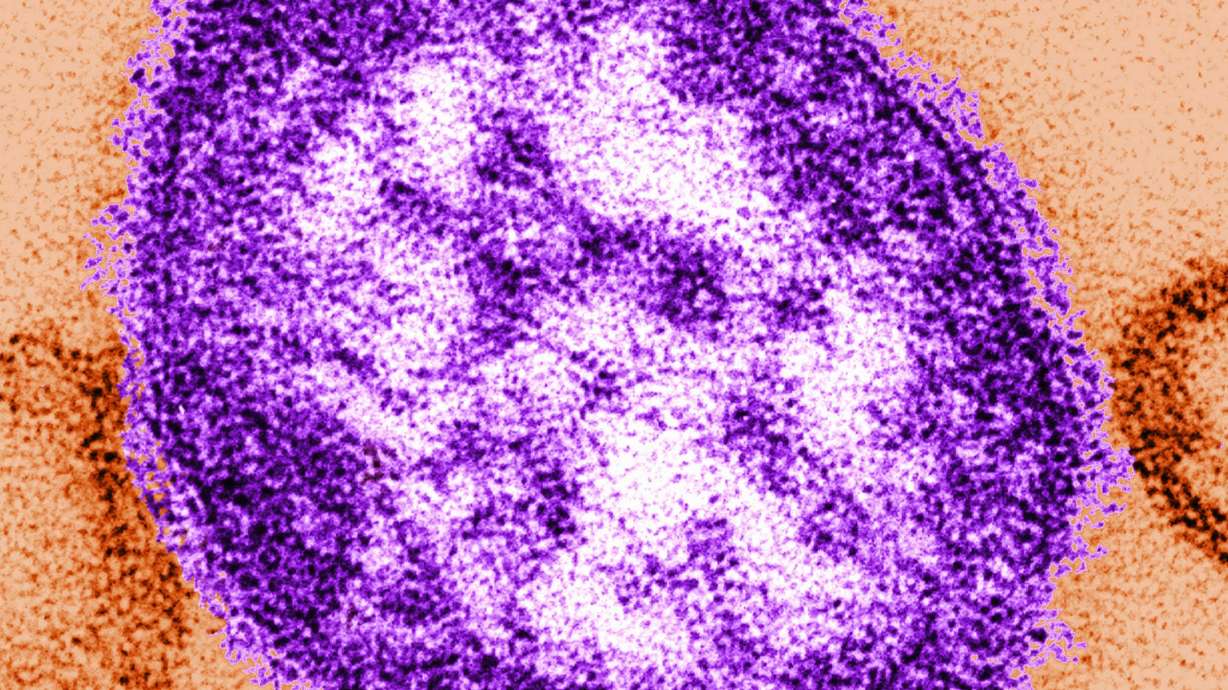 Pennsylvania tallies a fifth death related to measles as outbreak approaches a thousand cases