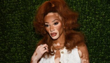Winnie Harlow Responds To Criticism Of Whitney Houston Costume