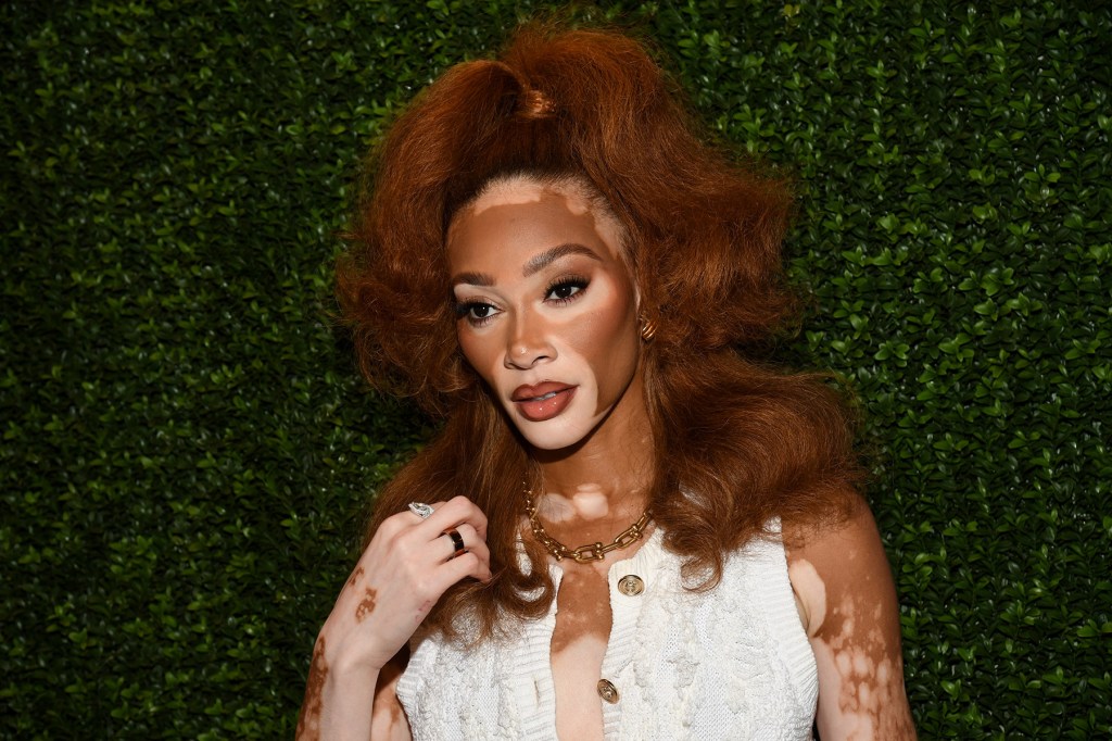 Winnie Harlow Responds To Criticism Of Whitney Houston Costume