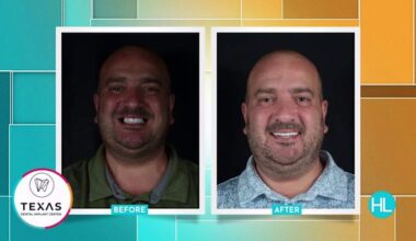 How AI and OneArch are changing full-mouth restorations in Houston