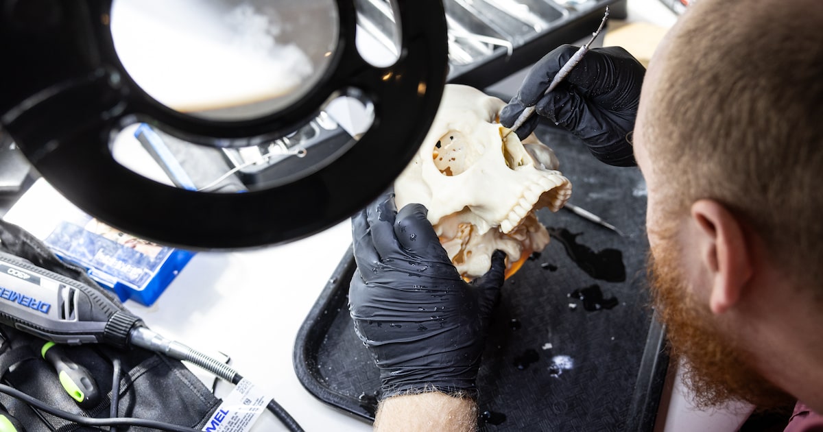 Dallas implant designer channels artistic talent to repair mangled skulls and jaws