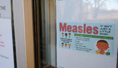 South Carolina measles outbreak surpasses Texas' 2025 total