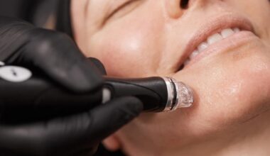 HydraFacial is a type of hydrodermabrasion that extracts and rejuvenates the skin. (Courtesy)