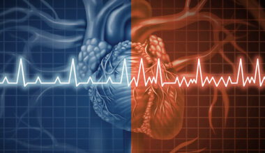 Fort Worth Hospital Ties Mayo Clinic as a Top U.S. Enrollment Site in Global Study of Life-Threatening Arrhythmias » Dallas Innovates
