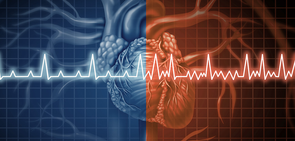 Fort Worth Hospital Ties Mayo Clinic as a Top U.S. Enrollment Site in Global Study of Life-Threatening Arrhythmias » Dallas Innovates
