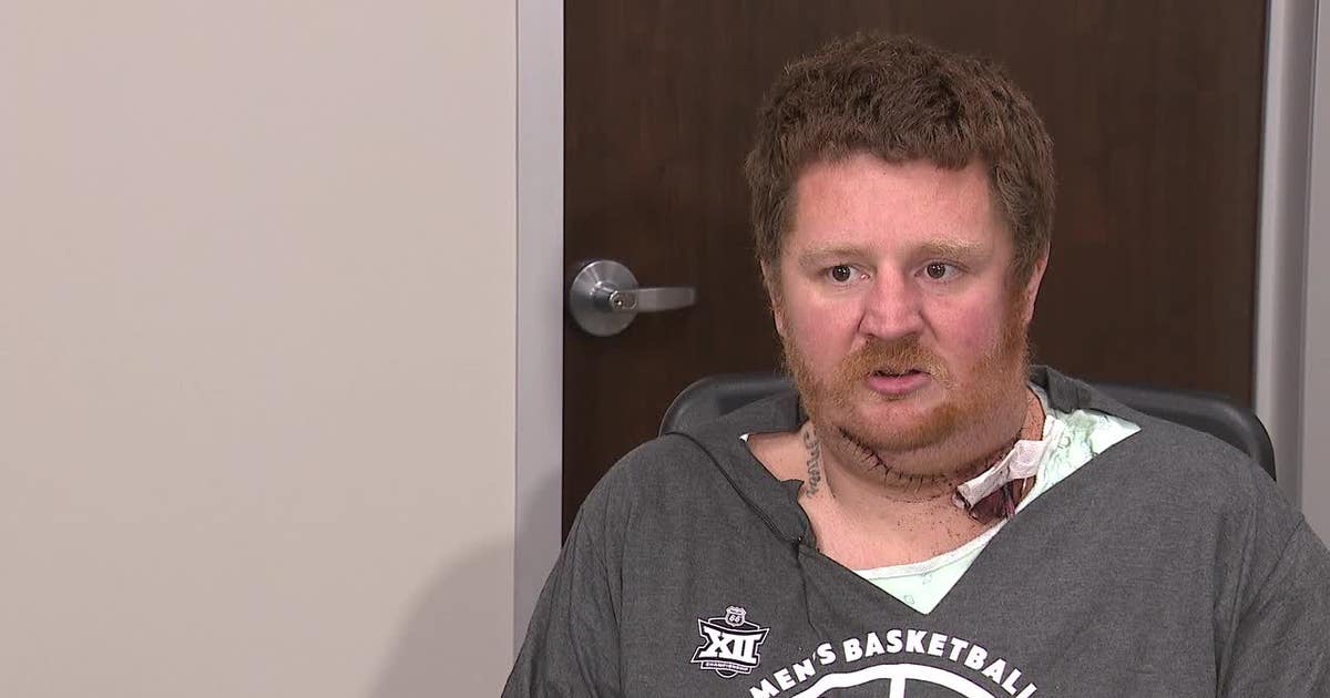 Dallas man has throat slashed by random attacker in broad daylight