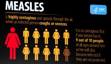 Measles has returned to Texas with new cases in four counties