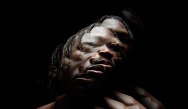 Prostate Cancer Epidemic: Black Men Diagnosed at Later Stages