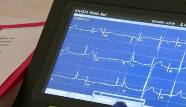 Free youth heart screenings at Houston Christian University