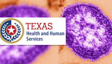 DSHS says there is no measles outbreak after cases reported in Kendall, Bandera counties