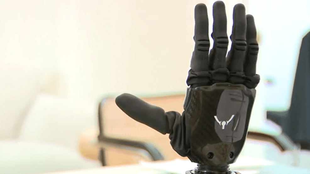 Phantom Neuro believes it has found a better way to control robotic limbs, not by implanting electrodes in the brain, but by tapping into the electrical signals muscles already produce.