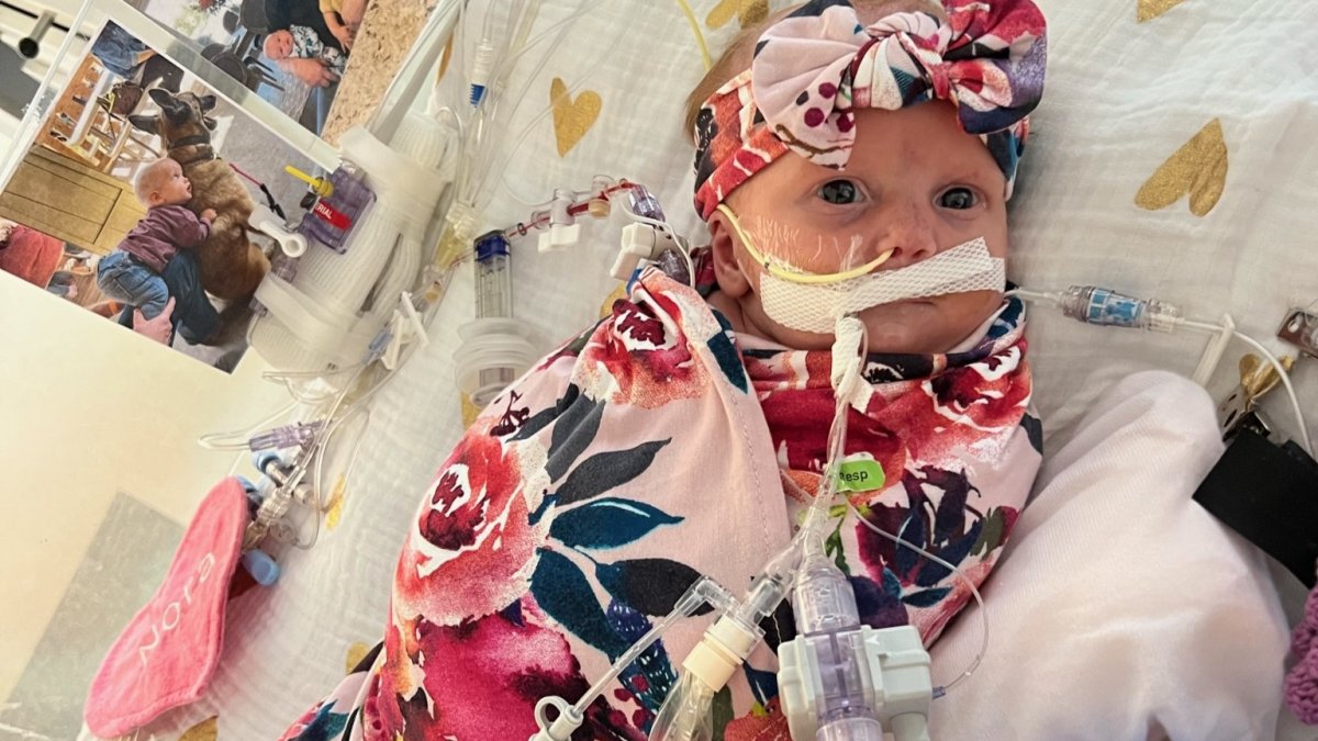 Congenital heart disease inspires Dallas parents to help families – NBC 5 Dallas-Fort Worth