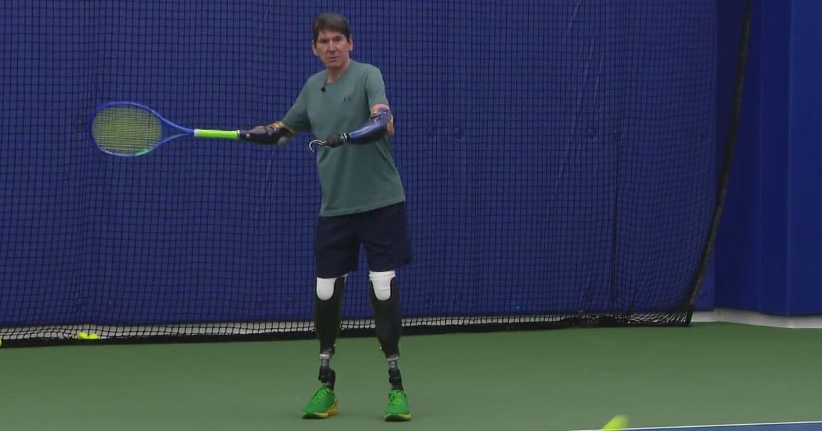 After losing all four limbs, Dallas tennis player plans inspiring US Open comeback: "I'm going to find a way."