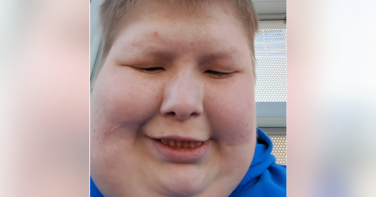 Texas officials searching for endangered missing man in Dallas