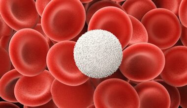 Leukopenia: 6 things to know about a low white blood cell count
