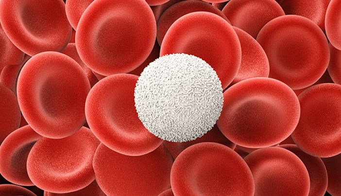 Leukopenia: 6 things to know about a low white blood cell count