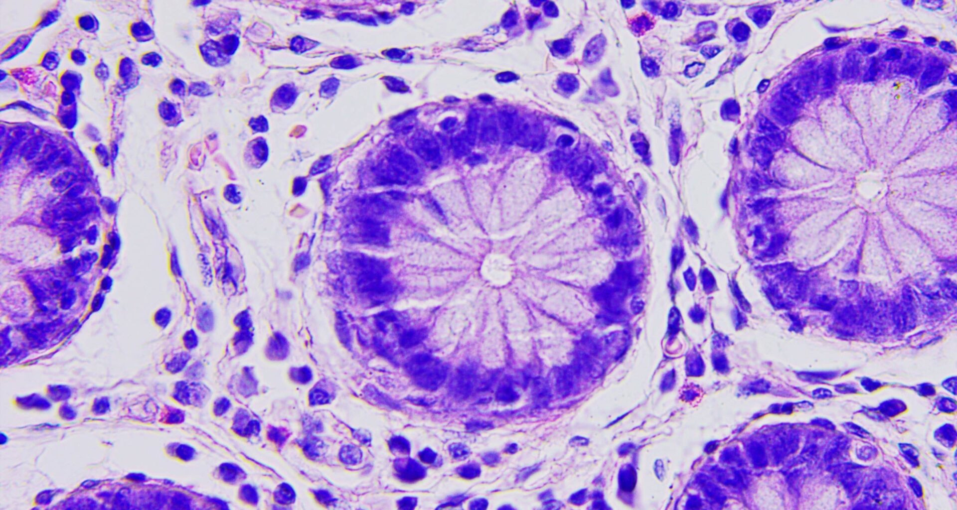 Experimental Chemo Drug May Trick the Immune System Into Fighting Cancer - UT Austin News